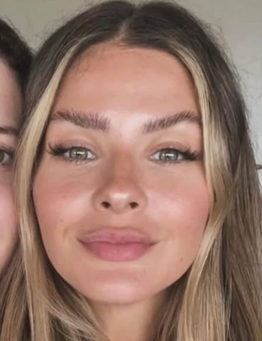 Che que pasó con la que no tenía botox porque es “actriz”? ahora tiene la cara tiesa🤣 no te acostumbres a la vida de millo moncha, que cuando rechacen la restitución internacional vas a tener que volver a arg a mendigar q te llamen por una publicidad de medialunas aunque sea💩💩