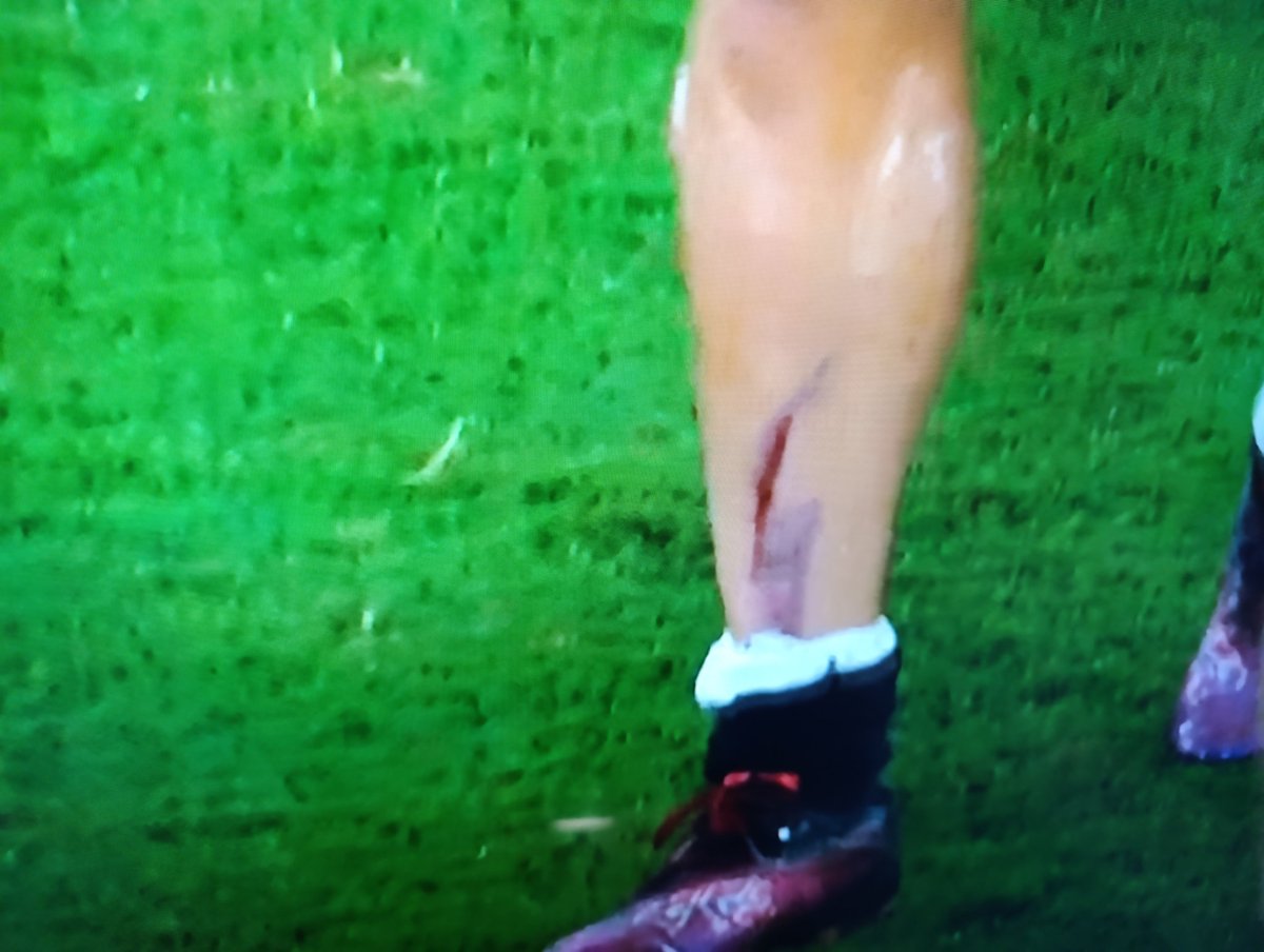 Si esta entrada a Kevin no es Roja que tiene que ser que le rompa la tibia.