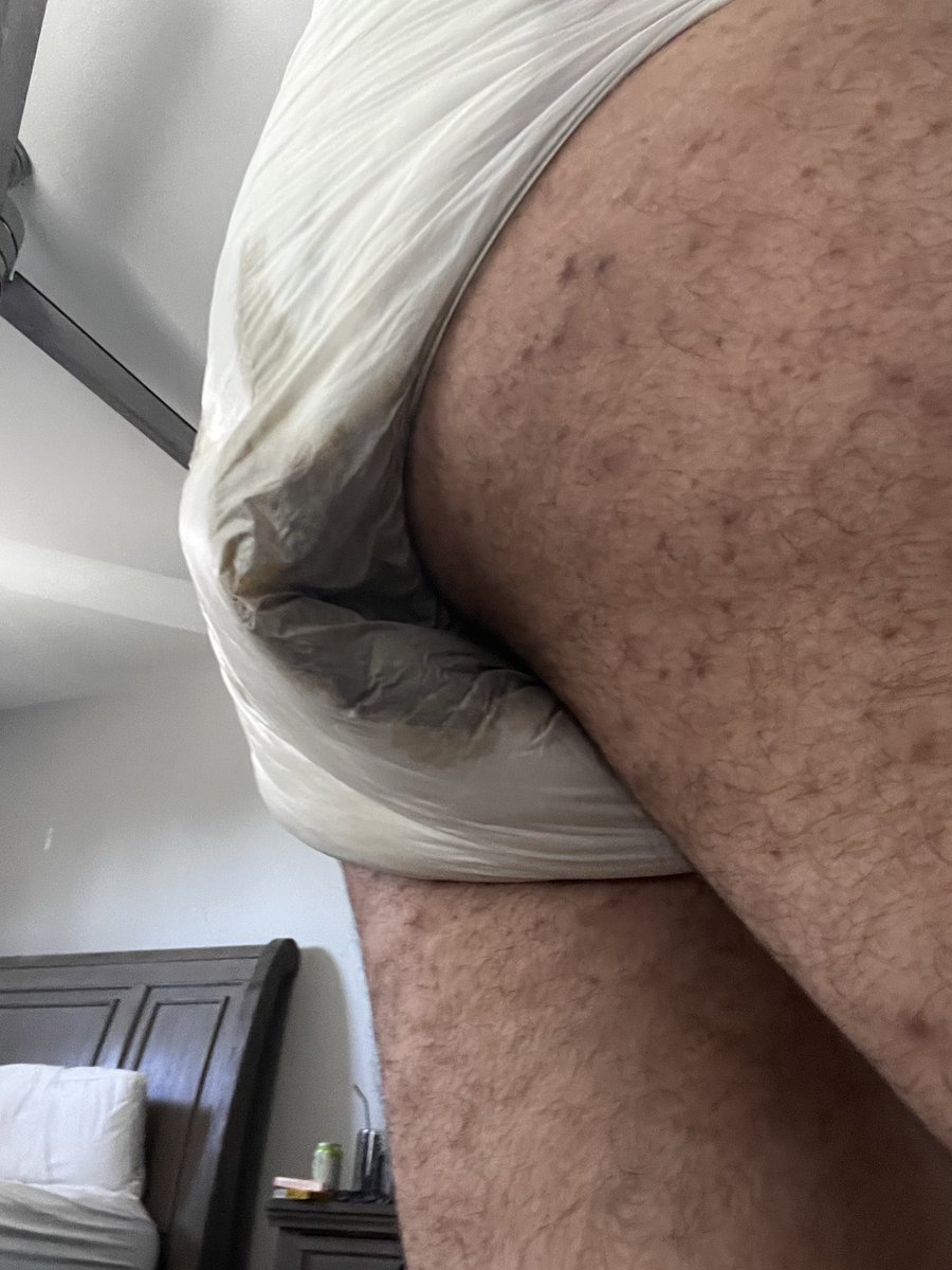 i made a wittle bit of a mess 💩 

#abdl #gayabdl #adultbaby #diaperlover #diaper #diaperboy #diapergay #wetdiaper #messydiaper