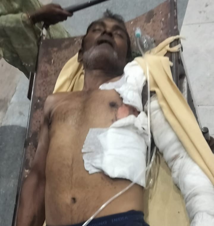 उ.प्र.के औरैया जनपद के केशमपुर विद्युत उपकेन्द्र पर तैनात संविदा कर्मचारी, अरविन्द पाल की बिजली कि चेट में आने से मौत हो गई। जिसका मुख्य कारण कर्मचारियों कि छंटनी करना है। 2022 से पूर्व इतनी दुर्घटनाएं नहीं होती थी।ऊं शान्ति ऊं।
<a href="/narendramodi/">Narendra Modi</a> 
<a href="/myogiadityanath/">Yogi Adityanath</a> 
<a href="/aksharmaBharat/">A K Sharma</a>