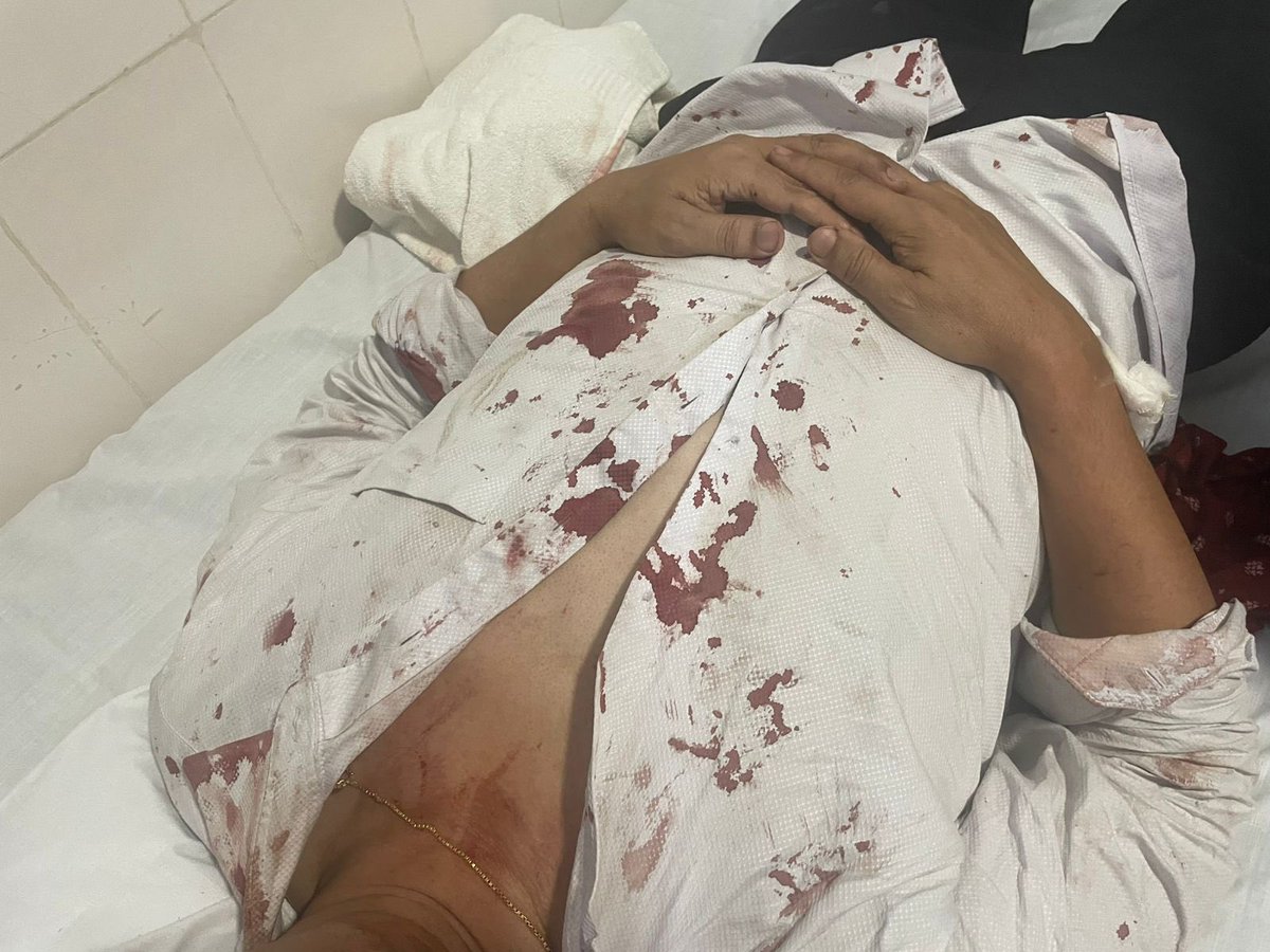 DrJsinghRajawat's tweet image. Today, an extremely shocking incident occurred in Department of obs and gyane Rims imphal ,Following an unfortunate maternal death. Senior professor went to counsel the patient’s relatives. In response, he was brutally attacked in an attempt to murder him inside the hospital…