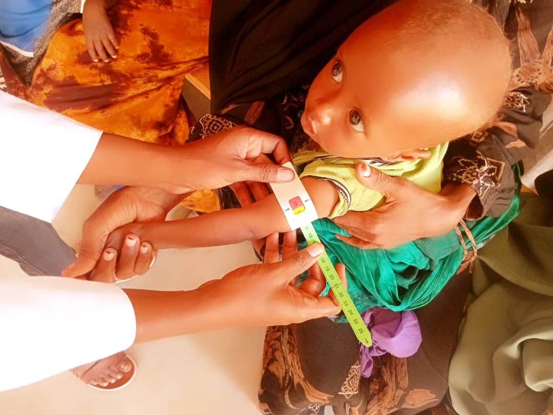 activeindevaid's tweet image. Malnutrition remains severe in Somalia, particularly children at risk of acute malnutrition due to climate changes and persistent conflict. ADA ensures screening and treatment of children with acute malnutrition in Ceel-waq in partnership with @unicefsomalia