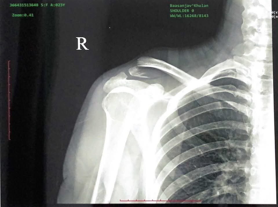 Иргэн Цэцэг: Шэйр хийж өгч туслаарай! 
9 сарын 3ны өдөр талбайн зүүн талын гарцаар гарч явсан хүүхдийг гарцан дээр мөргөж гэмтээсэн Alpard машины жолоочоо хүн чанараа гээсэн новшоо хүүхэд болохоор нь дээрлэхээд хүн алах шахчихаад зовлон тоочоод ямарч хариуцлага үүрэхгүй бултаж