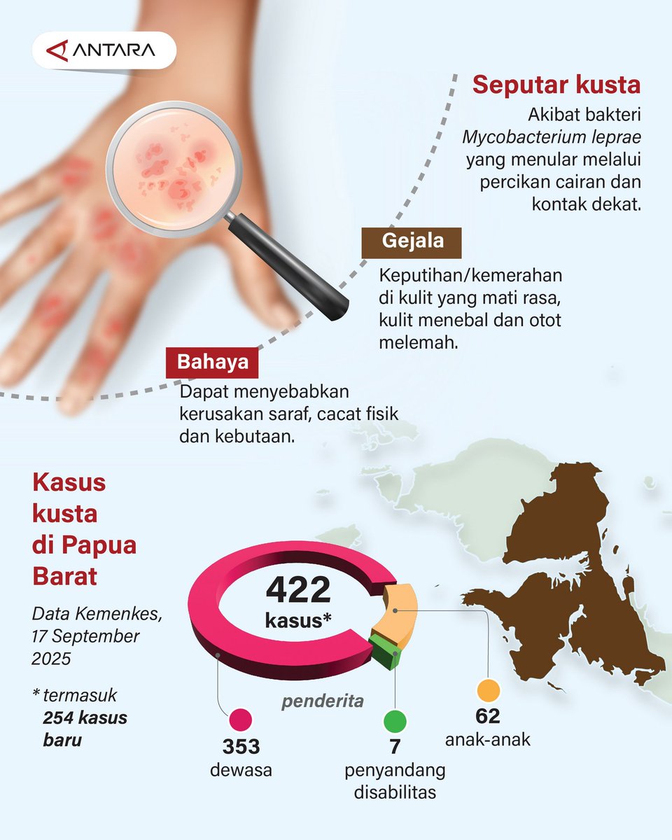 antaranews's tweet image. Kusta merebak di sejumlah kabupaten di Papua Barat pada 2025 sehingga Kementerian Kesehatan dan pemerintah daerah mengambil langkah-langkah penanganan untuk memberantas penyakit tersebut.

#kusta #penyakit #kulit #papua
Laman #infografik
antaranews.com/infografik/511…