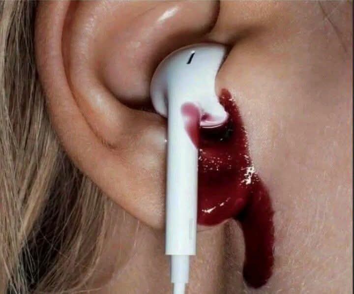 khustarperwaj's tweet image. आज 5 बजे मन की बात सुनने के बाद कान से...😀
#मोदीजी_इस्तीफा_दो
#ModiBhakt 
#DeshdrohiBCCI