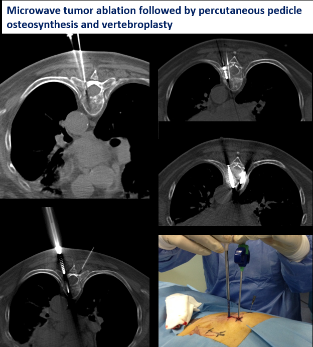 Interventional Oncology Institute tweet media