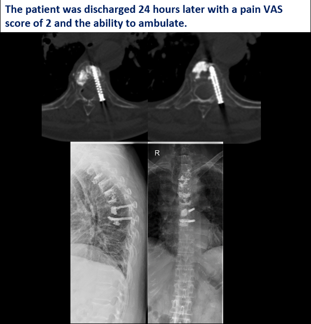 Interventional Oncology Institute tweet media