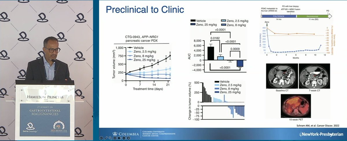 DAVAOnc's tweet image. Zenocutuzumab is a bispecific antibody blocking HER2-HER3 heterodimerization in NRG1+ cancers. Dr. @DrGManji from @ColumbiaMed discussed its activity in pancreatic cancer and recent FDA approval for use in NRG1 fusion+ PDAC. #DAVAGI