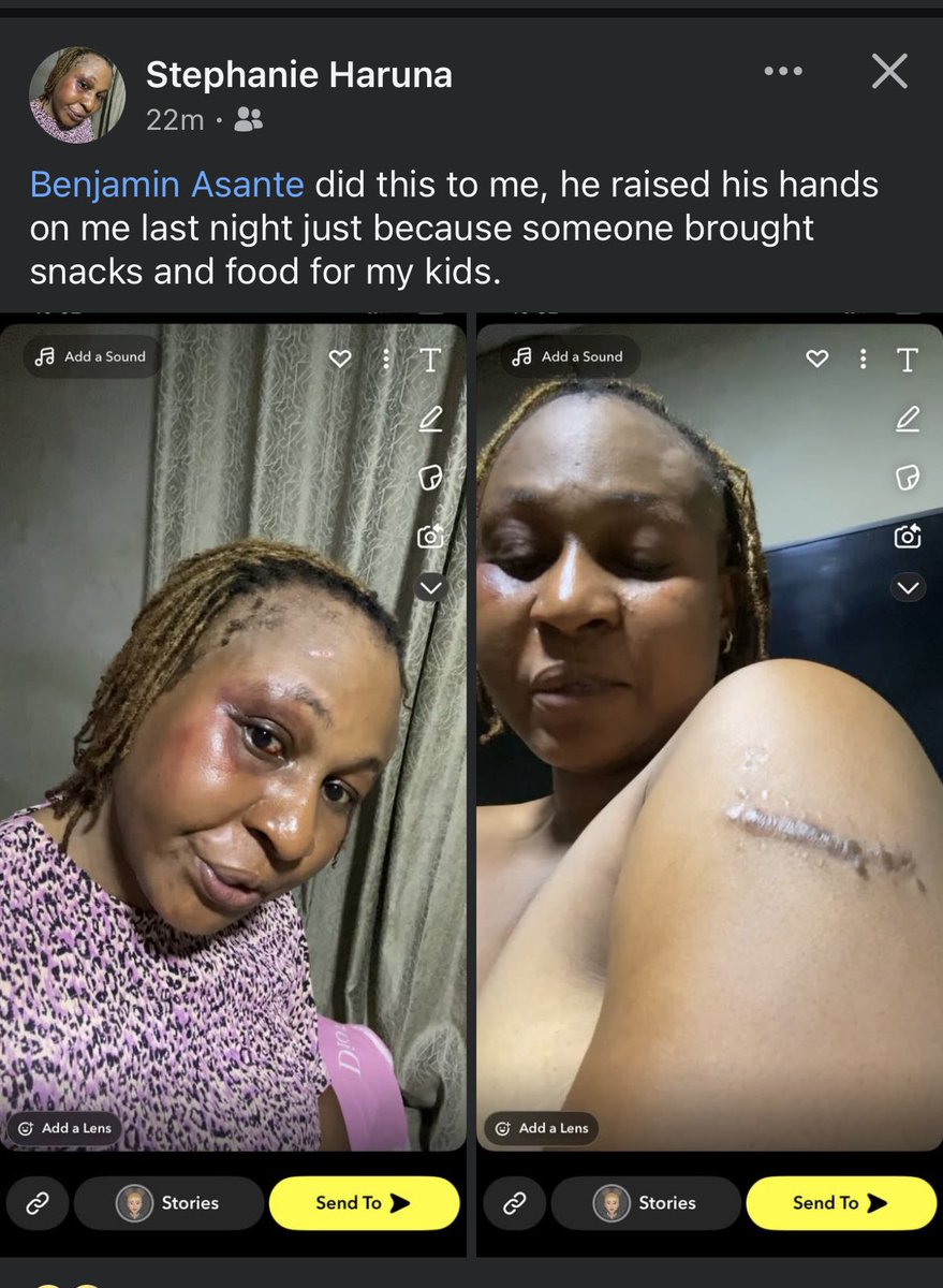 So this guy called Benjamin Asante married to Stephanie Haruna is a woman beater.  Some women are suffering oo all because of marriage. 
Lets all condemn Domestic violence <a href="/GhPoliceService/">Ghana Police Service</a> 

#FoundersDay #Tepa KingPromise
Osagyefo Dr. Kwame Nkrumah
the oheneba experience..