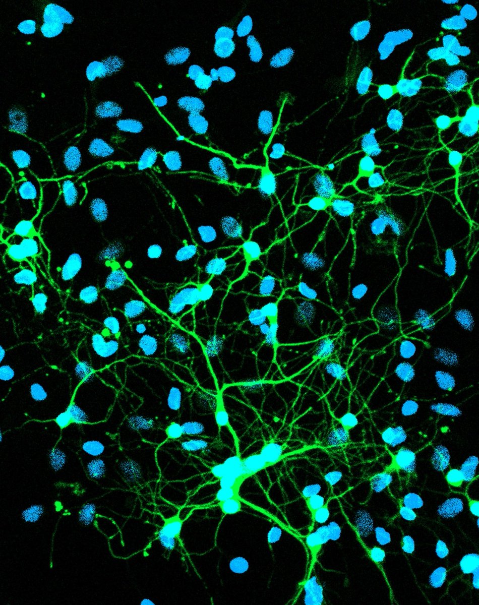 IIBCE's tweet image. 21 de septiembre | Día Mundial de la enfermedad de Alzheimer
Cada 21 de septiembre el mundo entero se une para visibilizar una de las enfermedades neurodegenerativas más prevalentes y desafiantes de nuestro tiempo: la enfermedad de Alzheimer (EA). 🧵