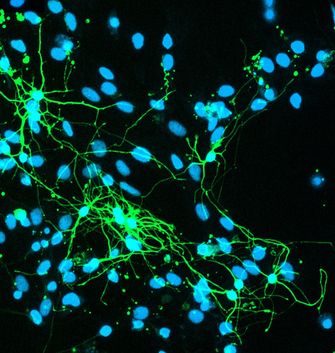 IIBCE's tweet image. 21 de septiembre | Día Mundial de la enfermedad de Alzheimer
Cada 21 de septiembre el mundo entero se une para visibilizar una de las enfermedades neurodegenerativas más prevalentes y desafiantes de nuestro tiempo: la enfermedad de Alzheimer (EA). 🧵