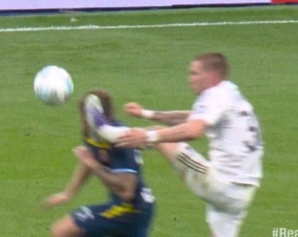 SpidyAtletico's tweet photo. Esto ayer no fue Roja. El pie lo tiene a nivel de la cabeza. Y le hizo un brecha a Romero. https://t.co/SdvTmbUdEu