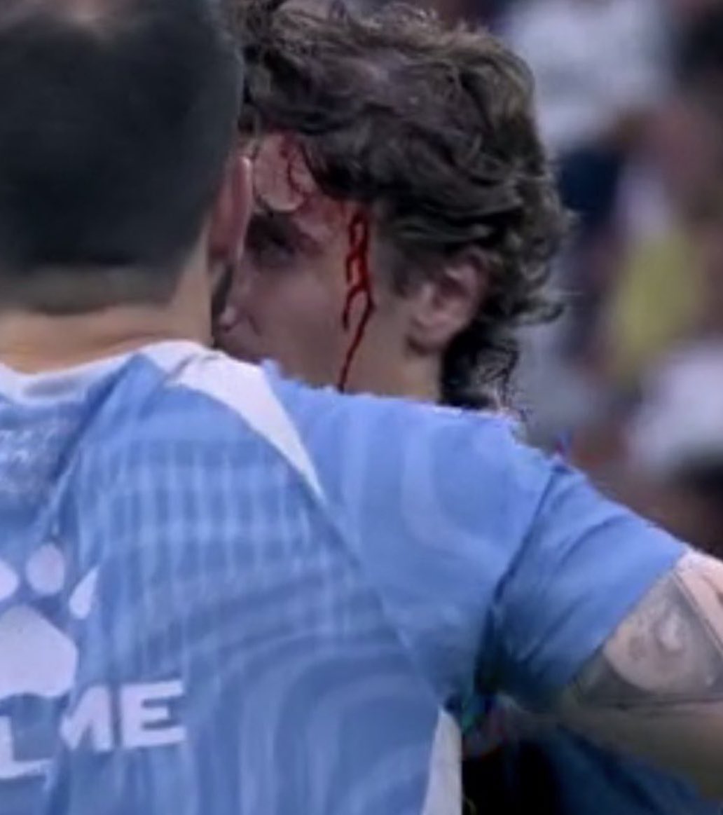 Hace 24h esto fue amarilla en el Bernabéu.