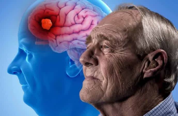 MINSAPCuba's tweet photo. 🇨🇺🧠||Cuba ante el Alzheimer: ciencia, prevención y humanidad

⚕️“La clave en el tratamiento en Cuba reside en los esfuerzos constantes de los profesionales médicos y el compromiso de instituciones científicas, que se unen para brindar los cuidados necesarios a la población”. https://t.co/e0lvTRnt2m