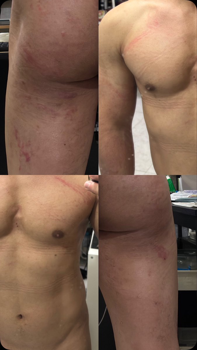 Marks by
<a href="/RopeAkeshi/">Akeshi</a> 
<a href="/RopeMongrel/">Mongrel || TPE 🇹🇼 10.23-30</a> 
<a href="/_ginagapos/">Kennethmove (🇹🇼 Oct 23-30)</a>