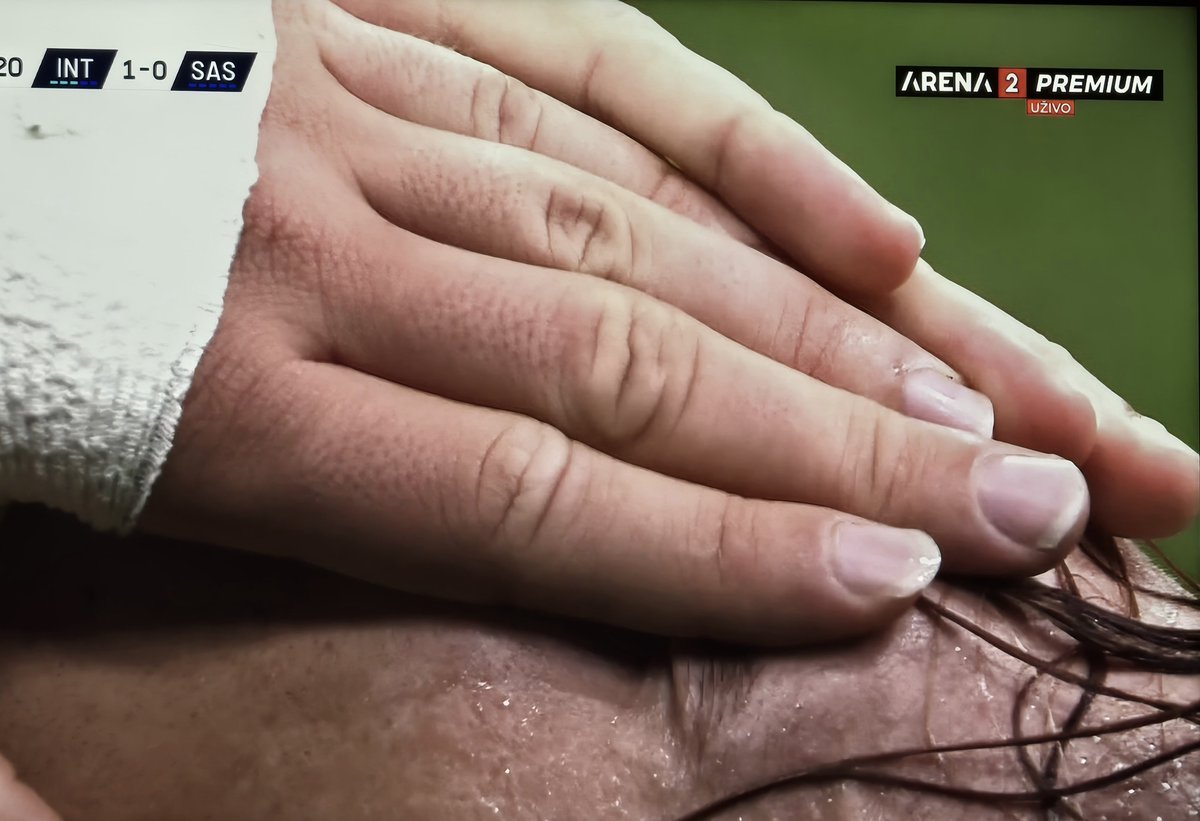 grokmmm's tweet image. Nails of Franceso Esposito 🤢🤮 #Inter
#InterSassuolo #SerieA