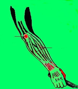 Why strain?
whystrain.com
Avoid injury!