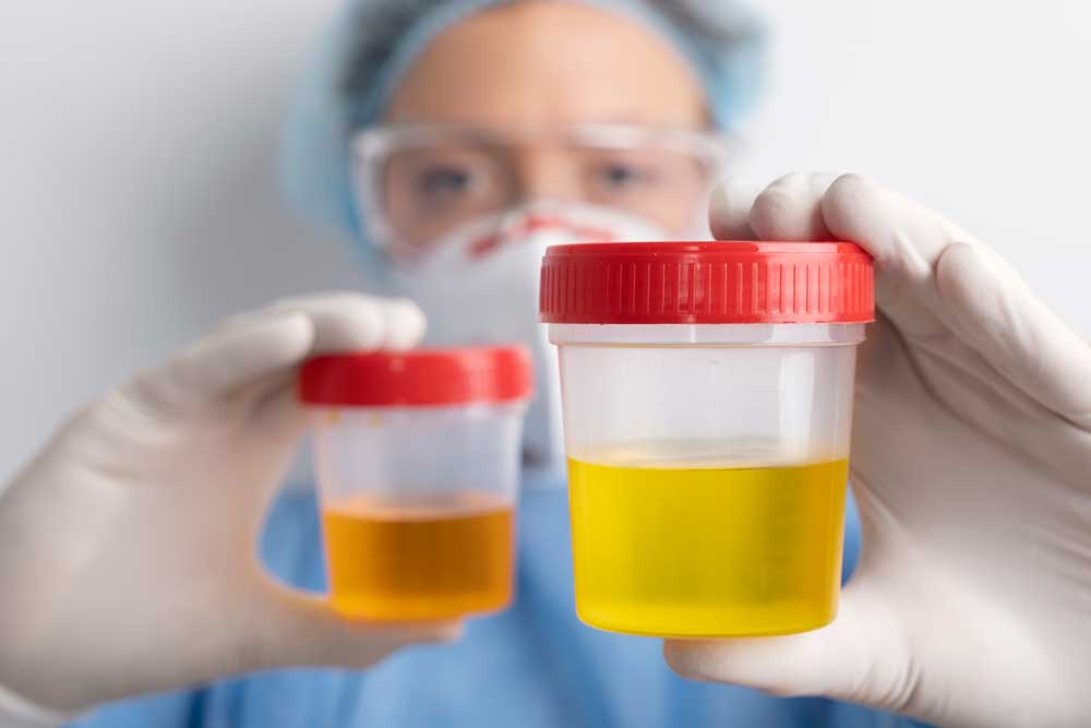 IntegSampling's tweet image. Can you really cheat a workplace drug test? Learn how sample tampering is prevented and why saliva testing makes cheating harder.
Read the full blog: integritysampling.com.au/2025/09/workpl…
#WorkplaceSafety #DrugTesting