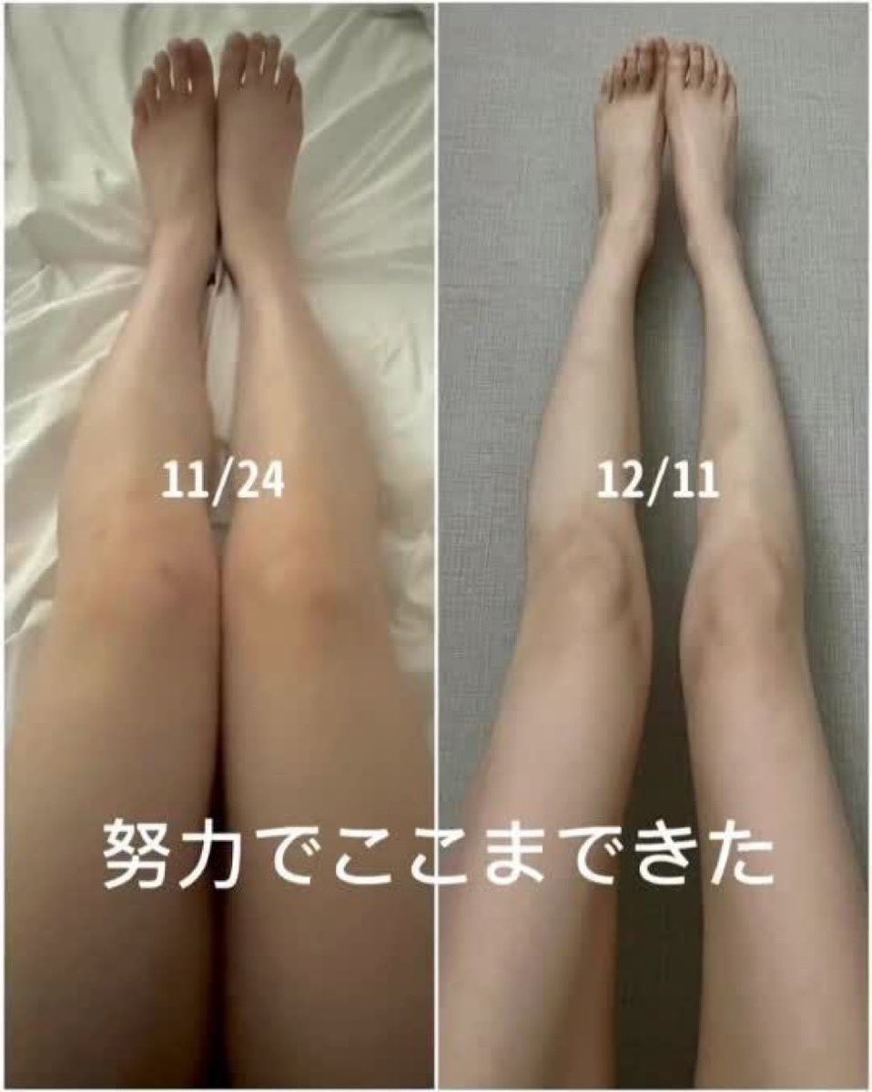 fainthunger's tweet image. #edtwt