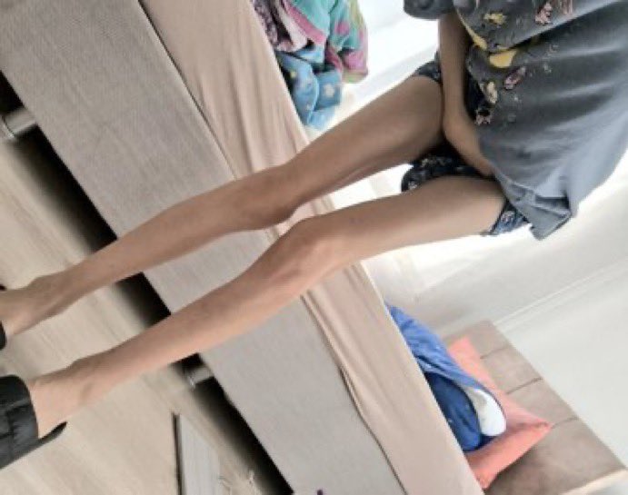 fainthunger's tweet image. #edtwt