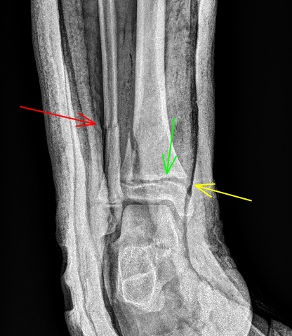 JuanMiranda tweet media