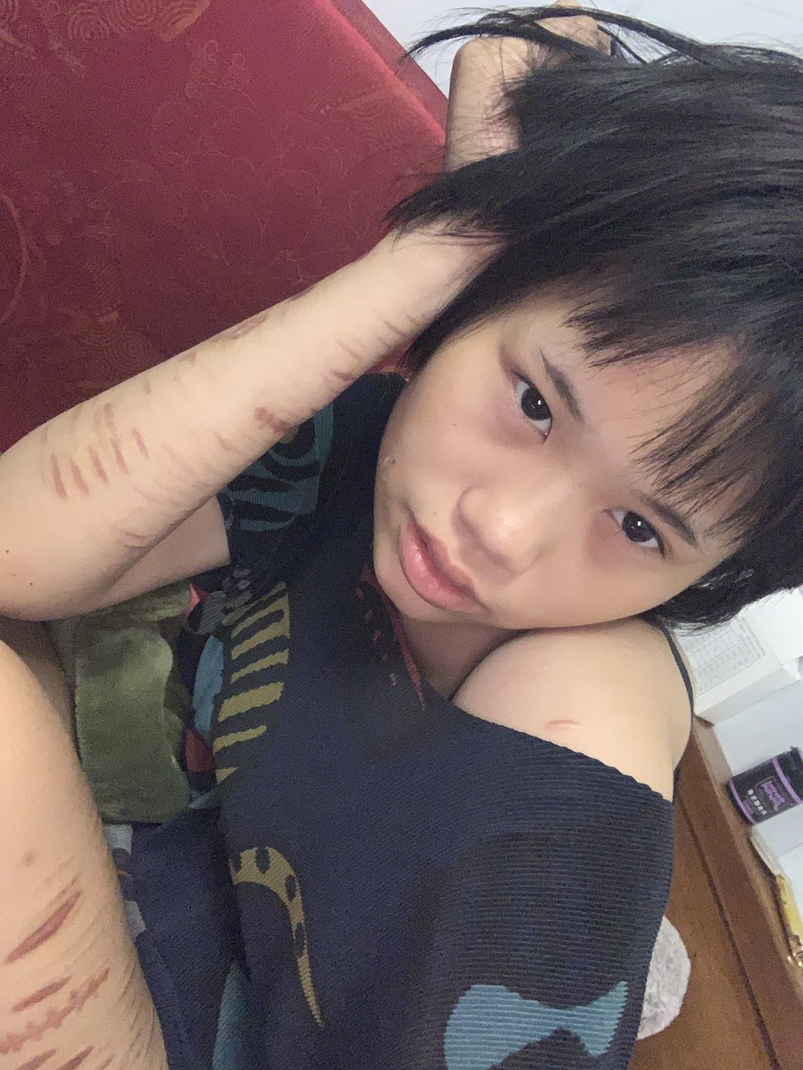 Cá vị Bạc Hà 🐟🩹 tweet media