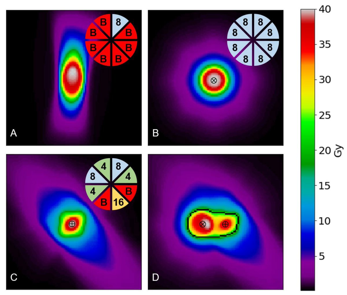 📈Highly Accessed Paper📈

💡"A 3D Superposition Approximation for Gamma Knife Dose Calculation" by Payton H. Stone et al.

🔗Read the full article here: mdpi.com/2673-592X/5/1/…

#GammaKnife #RadiationTherapy #MedicalPhysics #Dosimetry #Radiotherapy