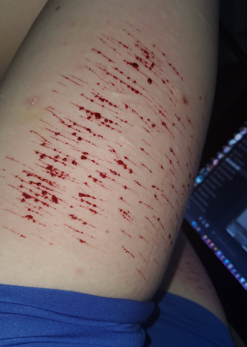 CW// SH (catscratches + shallow styros.)

Forgot to post this a while back. And by forgot I mean I didn't want to, because why are my thighs so big. Sigh.