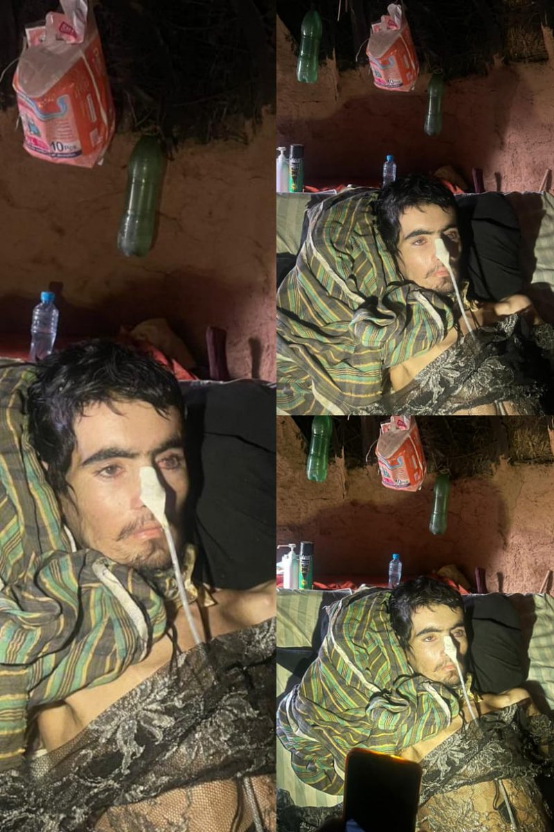 اپیل برائے امداد

 تاجک ایسوٹ کا نوجوان بیٹا غوث دین ایسوٹ ، جو لورالائی کی کوئلے کی کان میں مزدوری کر رہا تھا، 13 ماہ قبل ایک خوفناک حادثے کا شکار ہوا۔ اس حادثے نے اسے زندگی بھر کے لیے معذور بنا دیا۔

بدقسمتی سے علاج کے اخراجات برداشت نہ کر سکنے کی وجہ سے وہ آج بھی بستر پر بے