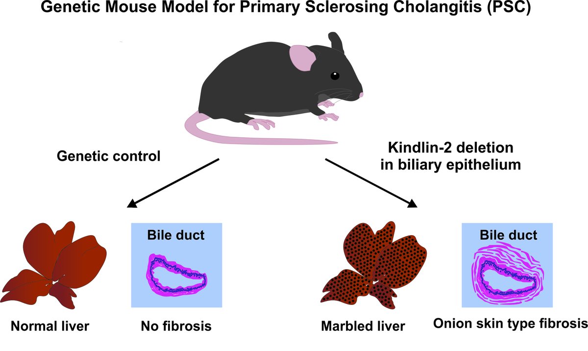 MetabolismAnd's tweet photo. 🧬Deleting Kindlin-2 in biliary cells disrupts tight junctions and triggers “onion-skin” fibrosis—mimicking key features of primary sclerosing cholangitis (PSC). A promising model for early disease research.

🔗https://t.co/L0SDdxhkhI

#PSC #LiverDisease #Fibrosis #Kindlin2 https://t.co/BBqhDq7jPO