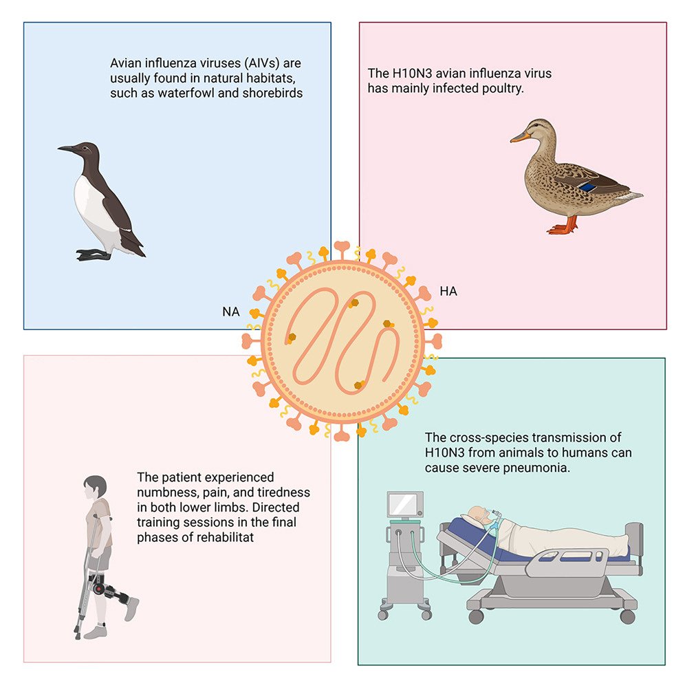 🚨 4th human case of H10N3 bird flu: A young woman in China developed severe pneumonia + complications, but recovered after antiviral + intensive therapy.
cell.com/med/fulltext/S…