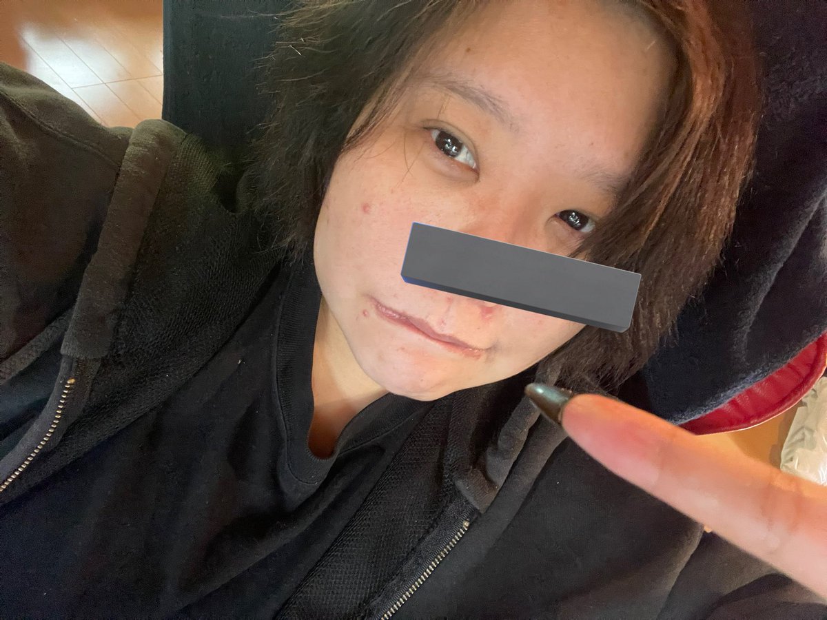 ニキビが大量！わんちゃん肌荒れ。
痛いし痒いし、、、増えていくし😭
昨日久々の化粧で気分よかったのに、今日の肌は荒れ放題🥹
この時間まで配信するか悩んでたけど、化粧ができないから、お休みします！明日は配信できるようにオロナインで炎症抑えてみる😭