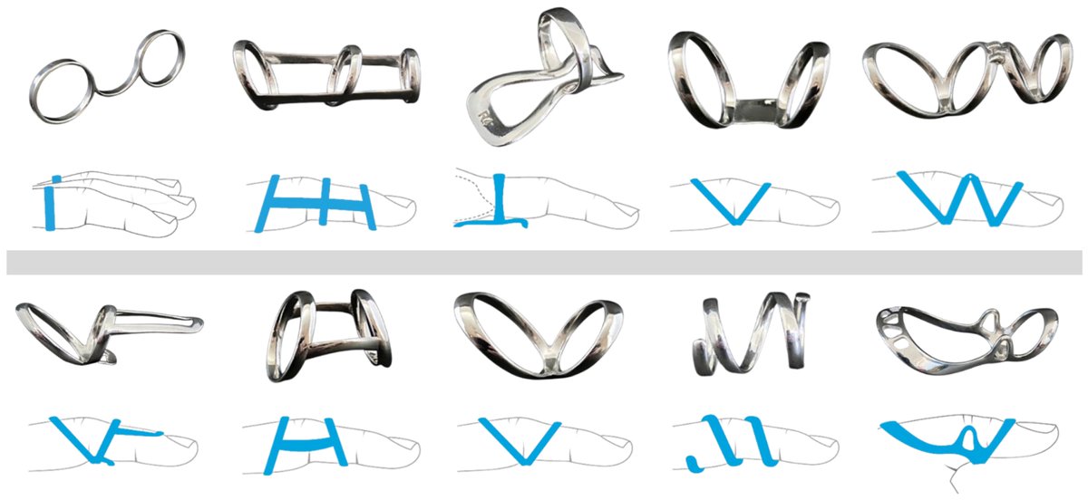 Prosthesis_MDPI's tweet image. This Part I review unpacks biomedical insights and additive manufacturing innovations of finger orthoses for rehabilitation, providing critical references for clinicians and engineers✋

doi.org/10.3390/prosth… 

#FingerOrthoses #AdditiveManufacturing #RehabilitationEngineering
