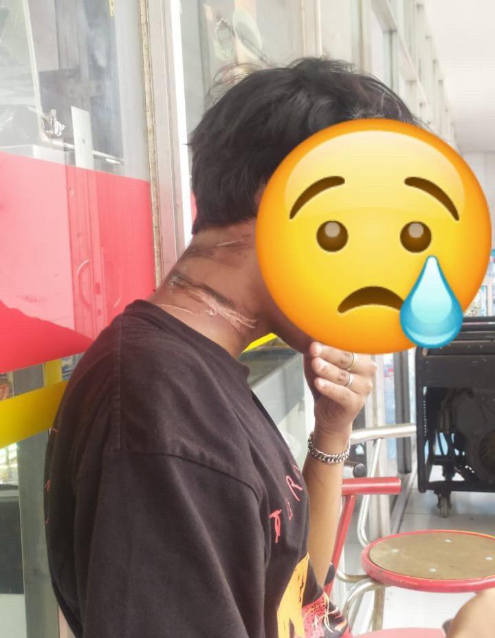 Jateng_Twit's tweet photo. Halo min, saya ijin share kejadian apes teman kerja saya siang tadi jam 14.00 lebih sedikit. Teman saya berboncengan,posisi teman saya yg mengemudikan motor, sedang diperjalanan mau ke daerah Magelang. Pas sampai Muntilan, tapi dia lupa lokasi persisnya, seingat dia di dekat masjid sebelum jalan searah. Dia dari arah Jogja, kebetulan berpapasan dengan truk towing yang sedang ngangkut truk juga. Pada saat bersamaan tiba-tiba ada kabel yg putus dan mengenai leher teman saya tsb. Kejadiannya begitu cepat sehingga dia panik, dan tidak melihat dengan jelas kejadian sebelumnya. Alhamdulillahnya dia tidak terjatuh. Tapi lehernya luka-luka 😢 Setelah itu dia tetep nerusin jalan dan baru berhenti di Ind*m*r*t untuk ngecek kondisinya. *Disclaimer dia tidak yakin apakah kabel itu putus karena terkena truk tsb atau memang tiba-tiba putus sendiri. Disini saya hanya membantu share info agar teman-teman semua tetap berhati-hati dijalan, karena hari apes tidak bisa diprediksi.🥺 Terimakasih min🙏🏻

Kejadian 21 September 2025
(Jalanpulang)
