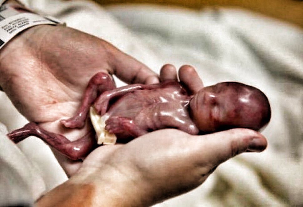 El #aborto es el #genocidio más cruel de la historia. Lo proteja una constitución o quien sea.
#SiaLaVida