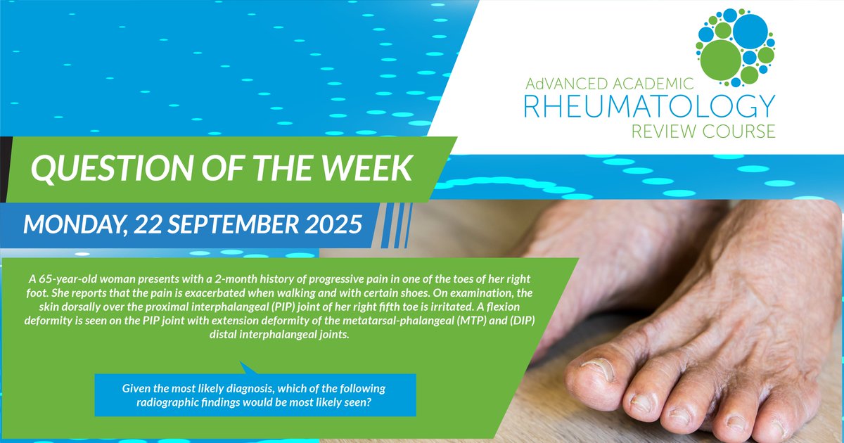 adarrc's tweet image. Try this week’s Monday Kickoff Quiz to explore clinical cases and test your understanding of the best next step in diagnosis for this week’s case: A 65-year-old woman with progressive toe pain and deformity
Take the Quiz: bit.ly/3IjuLPL
 #RheumQuiz #Rheumatology #AdARRC