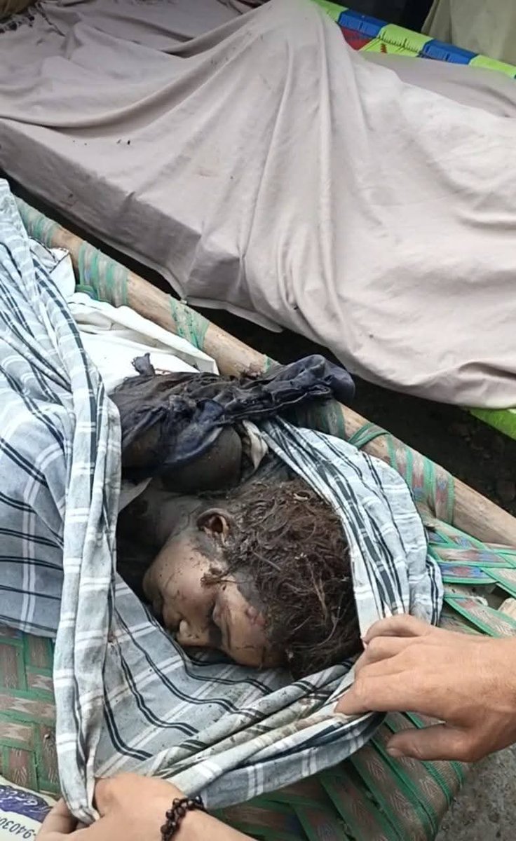 اس معصوم بچے کے چہرے اور بالوں پہ جمی ہوئی ملبے کی گرد اور اس میں شامل خون یہ بتا رہا ہے کہ اس کی جان لیتے ہوئے کوئی بھی اصول، کوئی بھی انسانیت، کوئی بھی ضمیر آڑے نہیں آیا۔ یہ مٹی اور یہ خون اس بے دردی کی داستان بیان کر رہے ہیں جو انسانیت کو شرمندہ کر دے۔

یہ بچہ جو آج مٹی میں