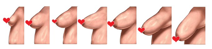 ããããªãã£ã±ãã®åœ¢ç¶ãçµµæãã§ã