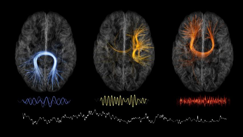 🧠 Beyin Dalgaları ve Zihinsel Durumlarımız

Farklı beyin dalgaları, ruh halimize ve bedenimizin durumuna göre ortaya çıkar. 

Bunları anlamak; zihinsel berraklık, huzur, yaratıcılık ve uyku kalitesi için çok önemli.

✨ Beyin dalgalarını yönetmeyi öğrenmek → zihinsel sağlık,