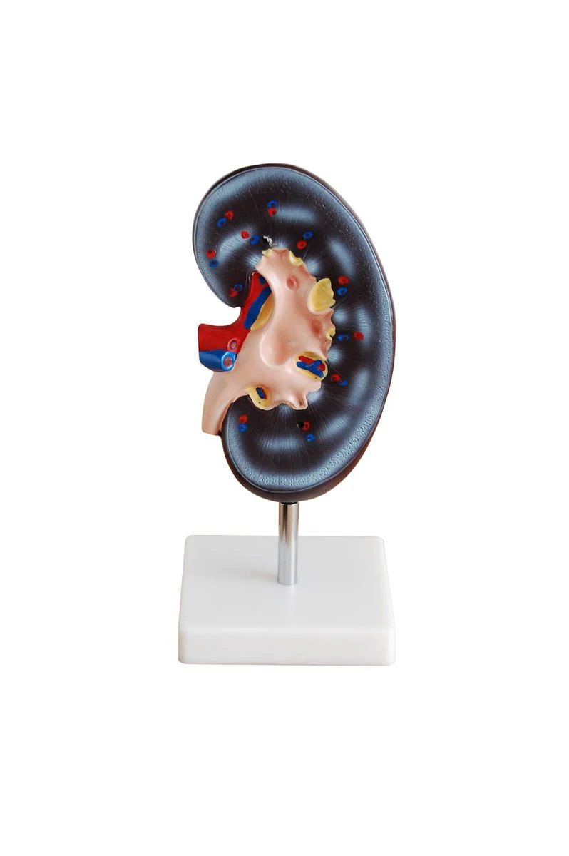 Whyzeenigeria's tweet image. Kidney Model Available!

Understand kidney anatomy with Whyzee&apos;s 1-Part Kidney Model! Accurate, durable. For medical &amp;amp; biology students.

🔷Purpose: Show basic kidney anatomy

Contact: info@whyzee.com.ng | 08035514153 | 07042686855.
#WhyzeeNigeria #KidneyModel #Anatomy #Nigeria