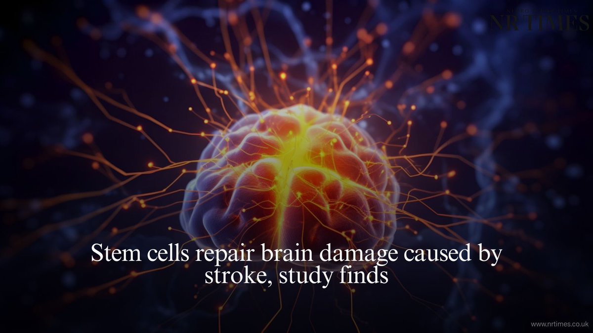 editorNRTimes's tweet image. Stem cell injections turned into immature brain cells and improved movement in mice with stroke damage, suggesting the therapy could one day repair lasting brain injury. 
🔗 Full story: buff.ly/wGd9aiQ 
#StrokeRecovery #StemCells #NeuroResearch #BrainHealth…