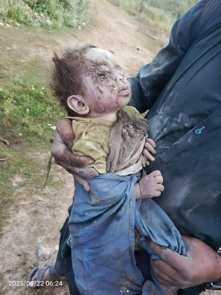 NisarBaaz's tweet photo. تیراہ میں معصوم بچوں پر بمباری بہت افسوسناک اور دردناک بات ہے اور اسی طرح عام  پشتونوں کے خلاف آپریشن بند ہونے چاہئیے 
#TirahMassacre https://t.co/eKIAucsgKe