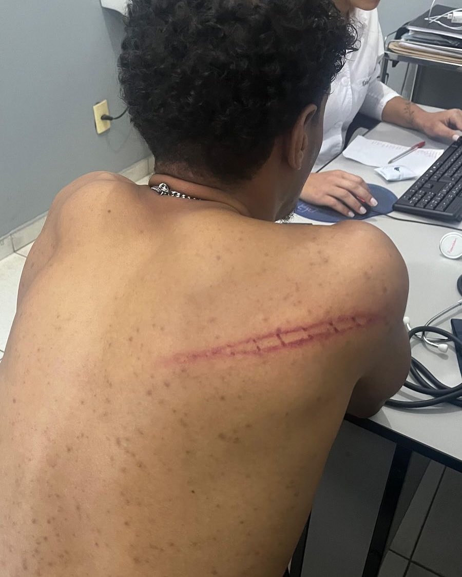 RogerioCorreia_'s tweet photo. No sábado (20), em Viçosa-MG, a PM transformou o lazer da juventude em um verdadeiro cenário de guerra: bombas de efeito moral, tiros de borracha, spray de pimenta e agressões físicas contra estudantes e a população. Entre os agredidos está o companheiro Carlos Daniel, dirigente estudantil e jovem negro, atingido de forma covarde.

Essa ação expõe a violência policial e o racismo estrutural que ainda atinge jovens negros e politicamente organizados. Minha solidariedade é total a Carlos e a todos que sofreram esse ataque.