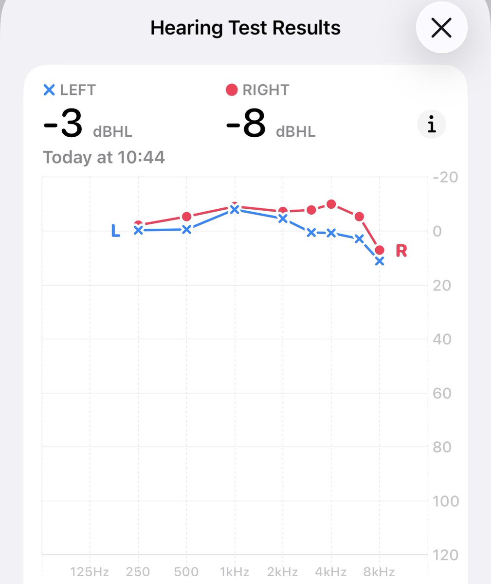 my hearing test kinda ate