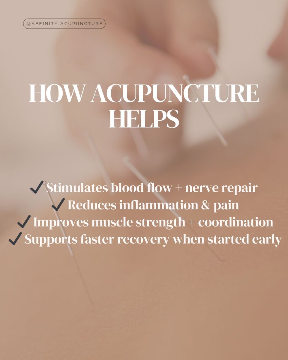 AffinityAcupunc's tweet image. Call us today at 615-939-2787 or visit affinityacupuncture.com to schedule your consultation
#acupuncture #facialparalysis #bellspalsy #acupuncturenashville #nerverecovery #naturalhealing #holistichealing #brentwoodtn #affinityacupuncture #neurologicalhealth #acupunctureworks