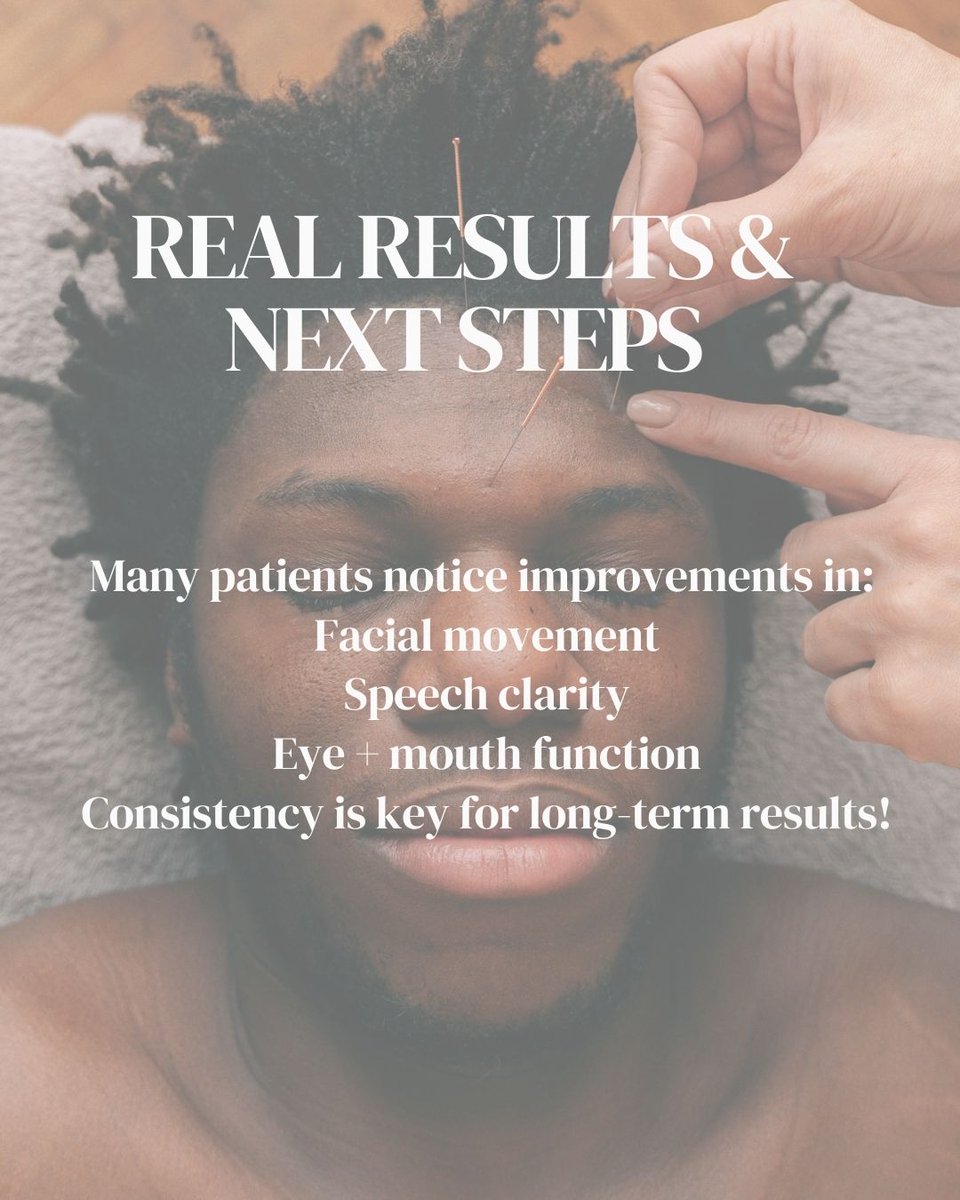 AffinityAcupunc's tweet image. Call us today at 615-939-2787 or visit affinityacupuncture.com to schedule your consultation
#acupuncture #facialparalysis #bellspalsy #acupuncturenashville #nerverecovery #naturalhealing #holistichealing #brentwoodtn #affinityacupuncture #neurologicalhealth #acupunctureworks