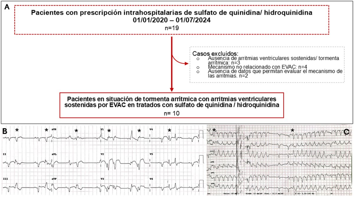 Quinidina en pacientes con tormenta arrítmica desencadenada por extrasístoles ventriculares de acoplamiento corto #reccardioclinics #Aheadofprint <a href="/NegreiraMartin/">Martín Negreira</a> <a href="/amarco8/">Ani Martín</a> <a href="/asenjo77/">roberto martin</a> <a href="/rsbodes/">Rafa Salguero Bodes</a> <a href="/ArribasInsa/">Fernando Arribas</a> @drdanielrod reccardioclinics.org/es-quinidina-p…