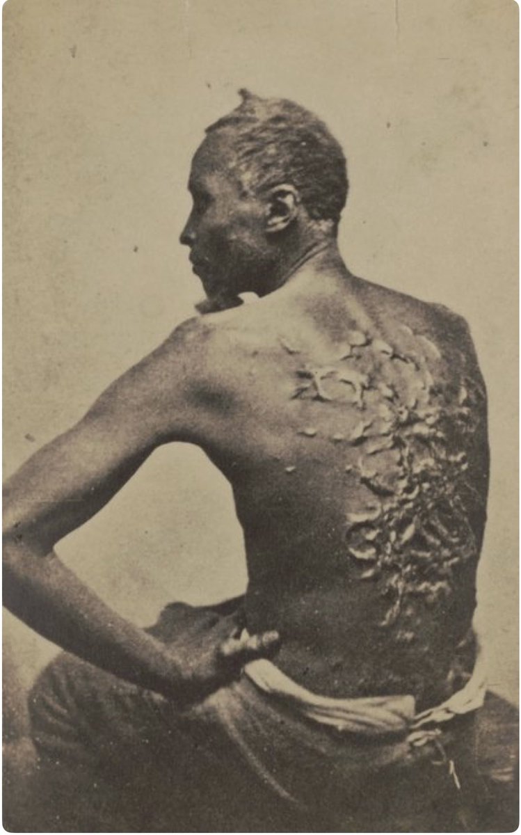 Yes, our ancestors bore the scars of the whip… but let’s not forget who held the whip. 

It wasn’t Christians showing the way to heaven.. it was Democrat lawmen, Democrat sheriffs, Democrat judges, Democrat politicians who wrote and enforced slavery and segregation into the very