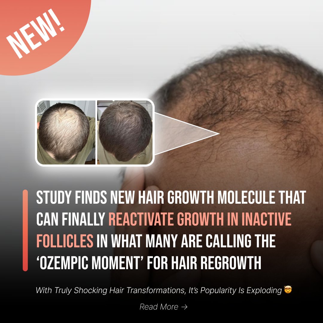 WILL | Static Ads tweet media