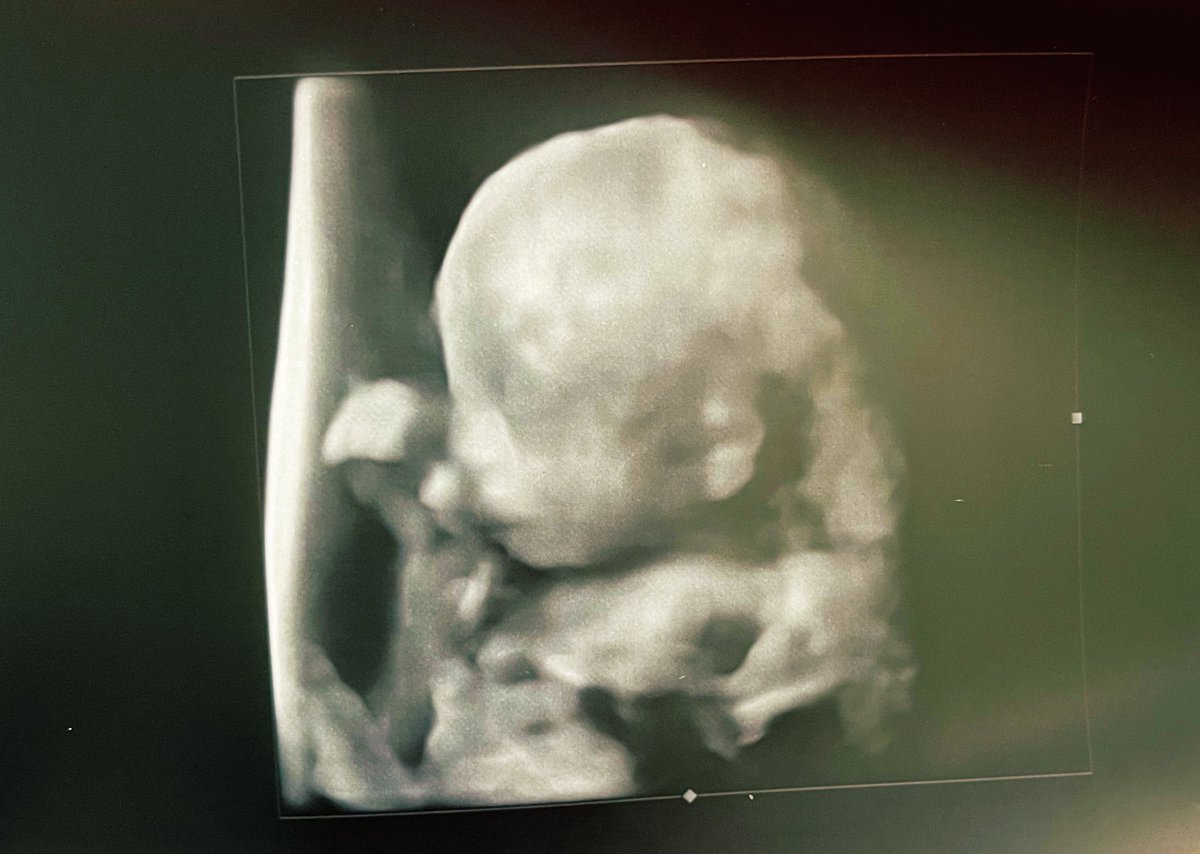 La forma dell’amore😍
Ancora qualche mese e potrò abbracciarti.
Piccola Alice ti aspettiamo ♥️ ♥️ ♥️